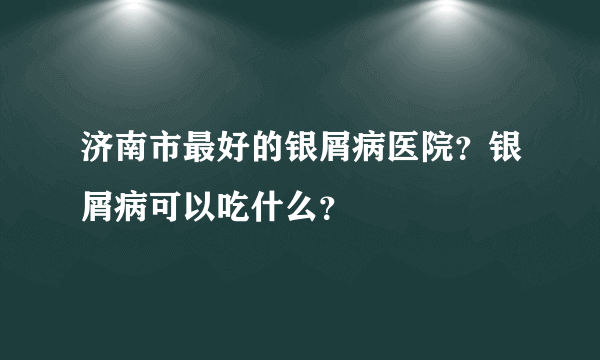 济南市最好的银屑病医院？银屑病可以吃什么？