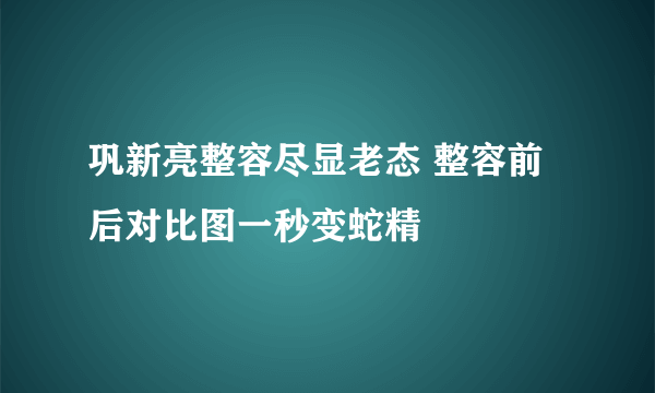 巩新亮整容尽显老态 整容前后对比图一秒变蛇精