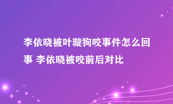 李依晓被叶璇狗咬事件怎么回事 李依晓被咬前后对比
