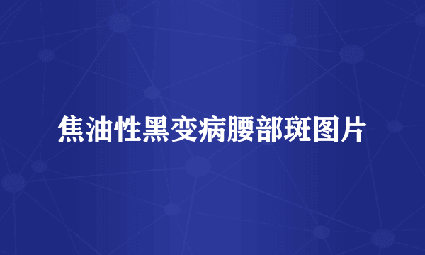 焦油性黑变病腰部斑图片
