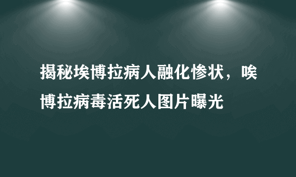 揭秘埃博拉病人融化惨状，唉博拉病毒活死人图片曝光