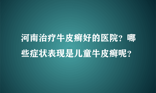 河南治疗牛皮癣好的医院？哪些症状表现是儿童牛皮癣呢？