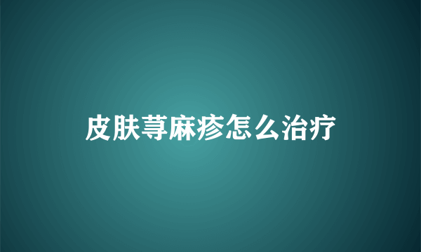 皮肤荨麻疹怎么治疗