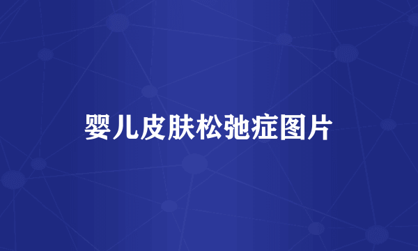 婴儿皮肤松弛症图片