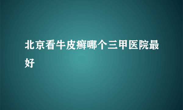 北京看牛皮癣哪个三甲医院最好