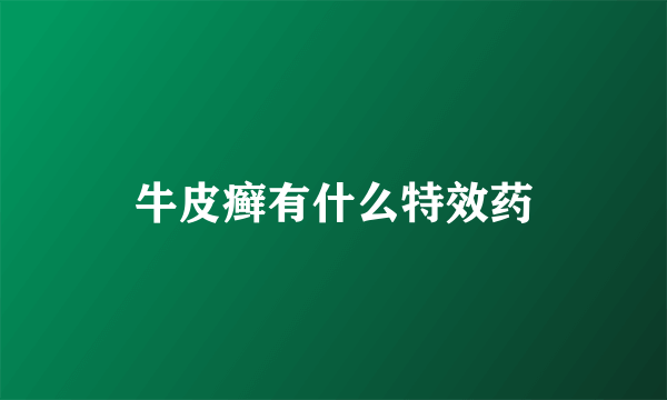 牛皮癣有什么特效药