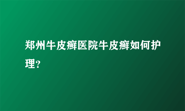 郑州牛皮癣医院牛皮癣如何护理？
