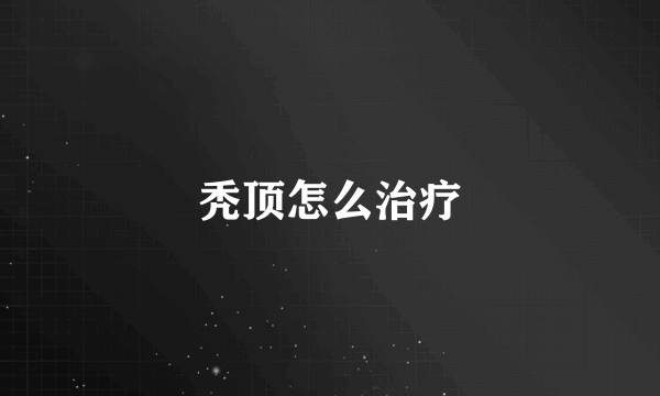 秃顶怎么治疗