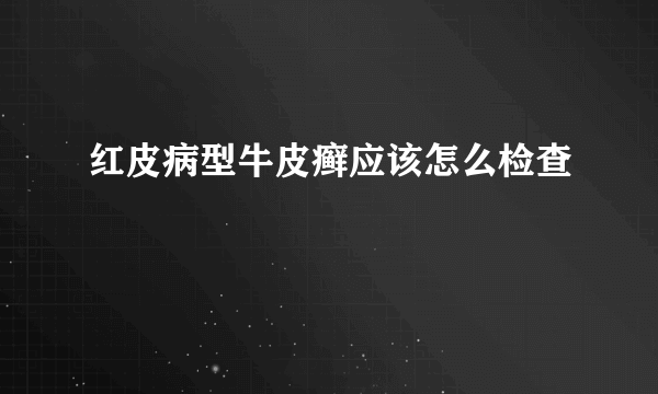 红皮病型牛皮癣应该怎么检查