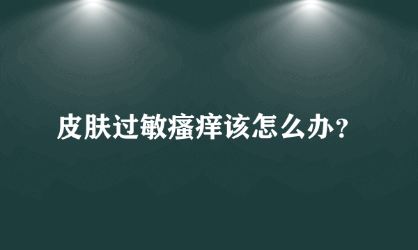 皮肤过敏瘙痒该怎么办？
