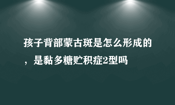 孩子背部蒙古斑是怎么形成的，是黏多糖贮积症2型吗