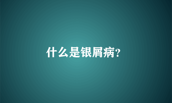 什么是银屑病？