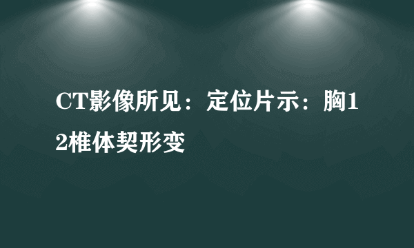 CT影像所见：定位片示：胸12椎体契形变