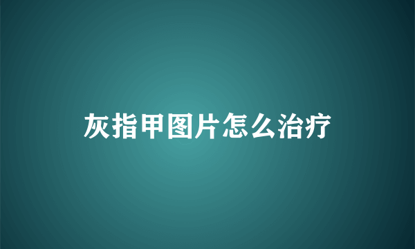 灰指甲图片怎么治疗