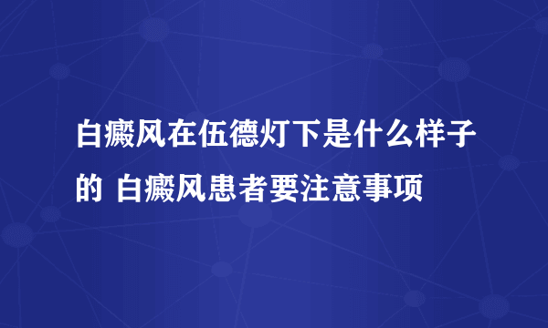 白癜风在伍德灯下是什么样子的 白癜风患者要注意事项