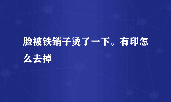 脸被铁销子烫了一下。有印怎么去掉