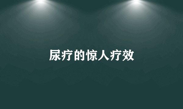 尿疗的惊人疗效