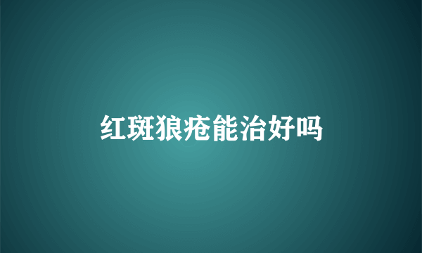 红斑狼疮能治好吗