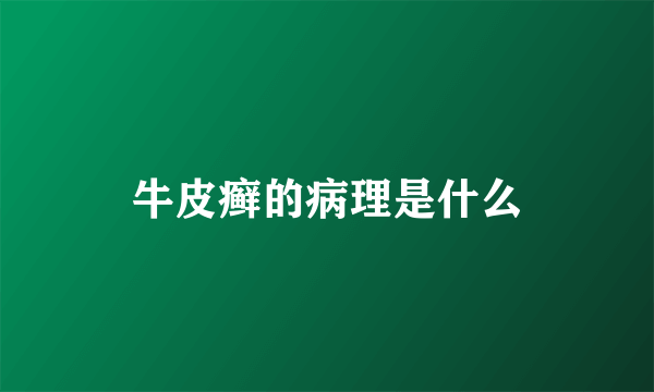 牛皮癣的病理是什么