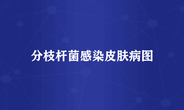 分枝杆菌感染皮肤病图
