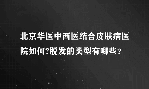 北京华医中西医结合皮肤病医院如何?脱发的类型有哪些？