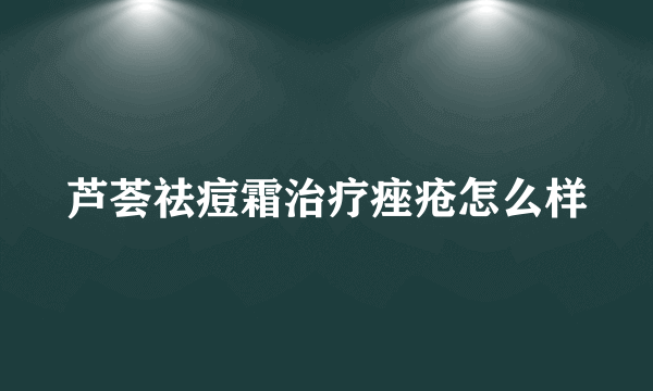 芦荟祛痘霜治疗痤疮怎么样