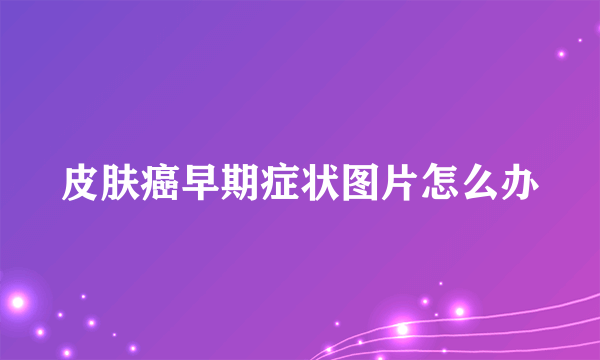 皮肤癌早期症状图片怎么办
