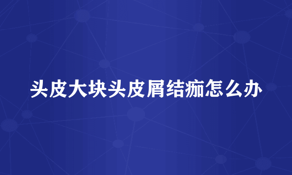 头皮大块头皮屑结痂怎么办