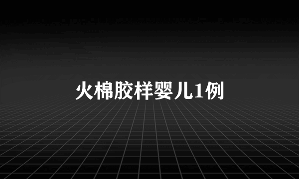 火棉胶样婴儿1例