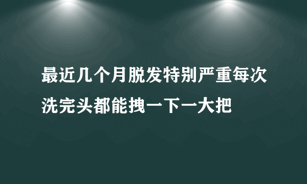 最近几个月脱发特别严重每次洗完头都能拽一下一大把