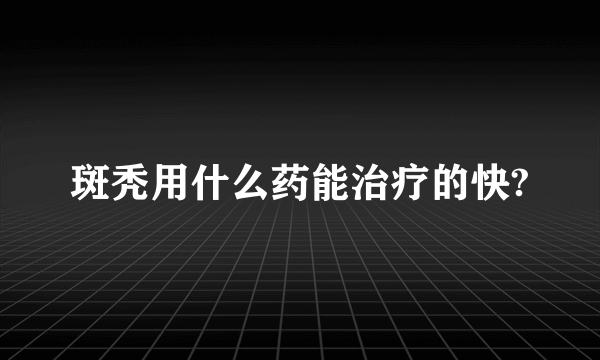 斑秃用什么药能治疗的快?