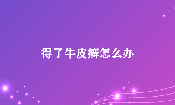 得了牛皮癣怎么办