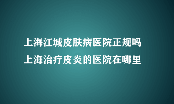 上海江城皮肤病医院正规吗 上海治疗皮炎的医院在哪里