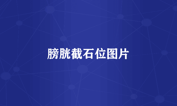 膀胱截石位图片
