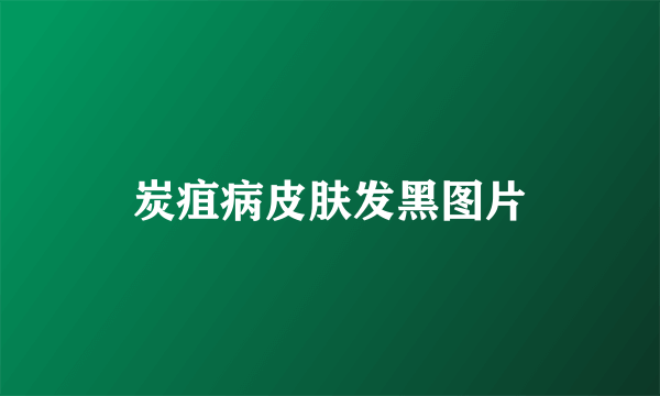 炭疽病皮肤发黑图片
