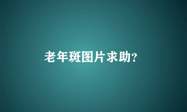 老年斑图片求助？