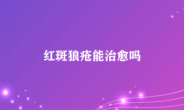 红斑狼疮能治愈吗