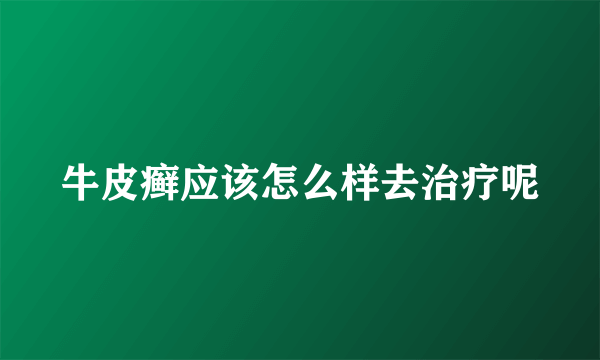 牛皮癣应该怎么样去治疗呢