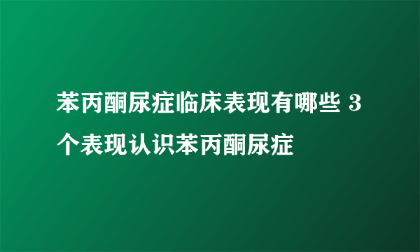 苯丙酮尿症临床表现有哪些 3个表现认识苯丙酮尿症