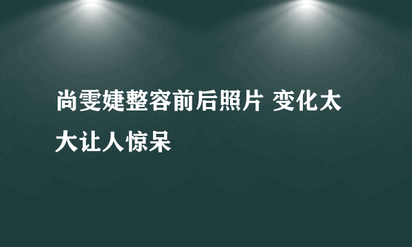 尚雯婕整容前后照片 变化太大让人惊呆
