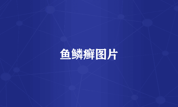 鱼鳞癣图片