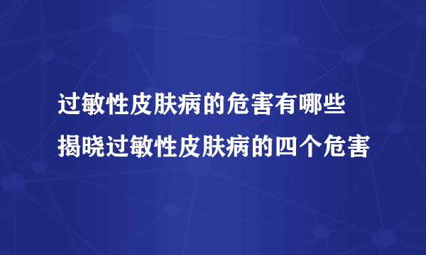 过敏性皮肤病的危害有哪些 揭晓过敏性皮肤病的四个危害