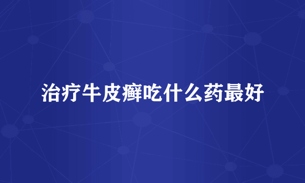 治疗牛皮癣吃什么药最好