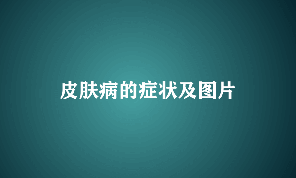 皮肤病的症状及图片