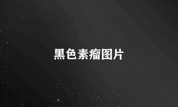 黑色素瘤图片