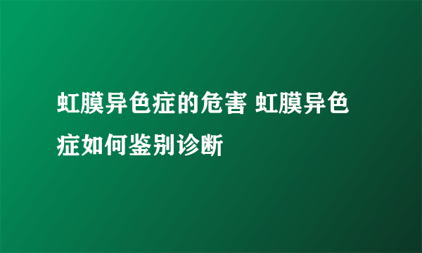 虹膜异色症的危害 虹膜异色症如何鉴别诊断