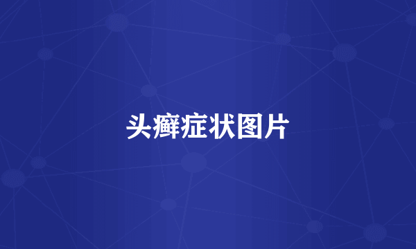 头癣症状图片