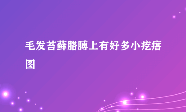 毛发苔藓胳膊上有好多小疙瘩图