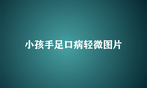 小孩手足口病轻微图片