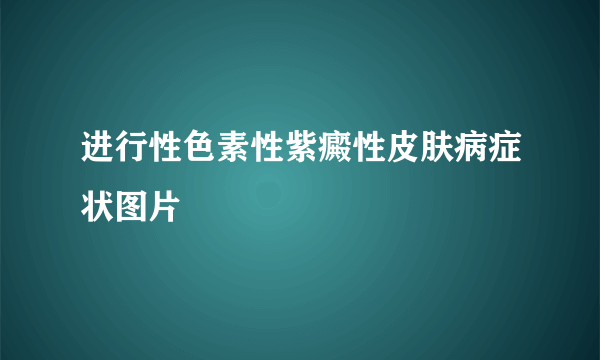 进行性色素性紫癜性皮肤病症状图片